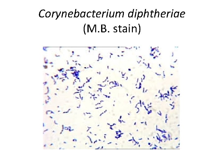 Corynebacterium diphtheriae (M. B. stain) 
