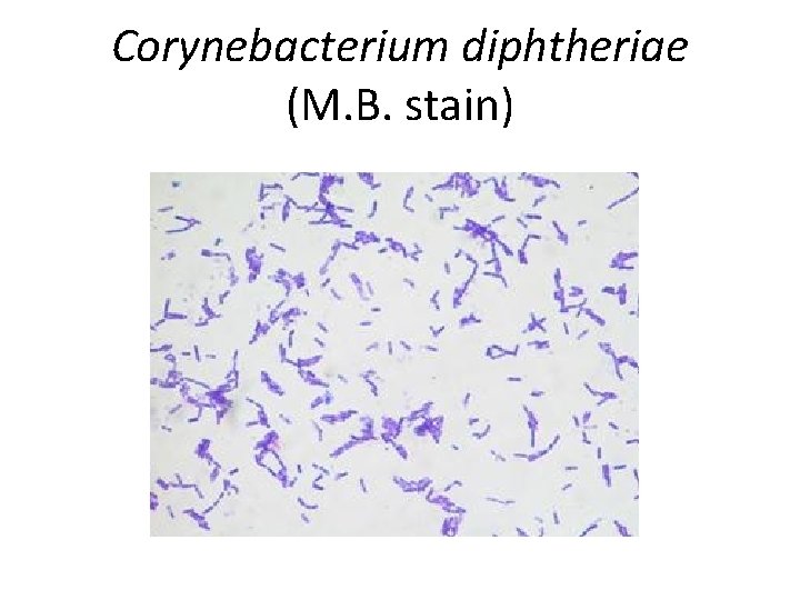 Corynebacterium diphtheriae (M. B. stain) 