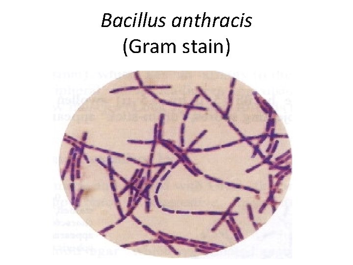 Bacillus anthracis (Gram stain) 