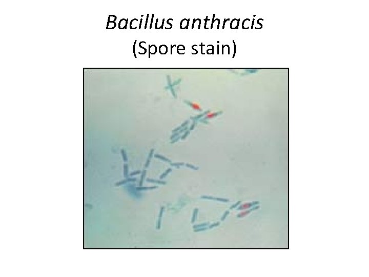 Bacillus anthracis (Spore stain) 