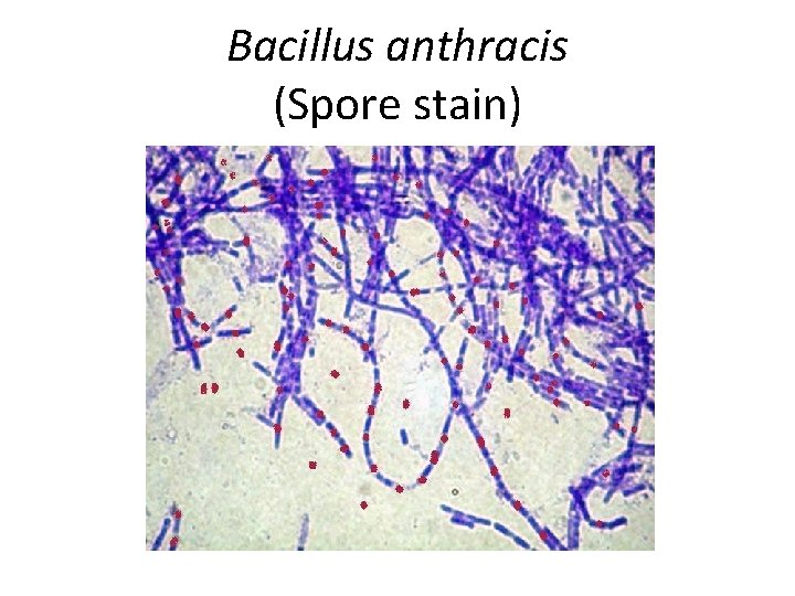 Bacillus anthracis (Spore stain) 