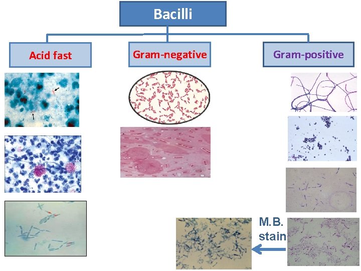 Bacilli Acid fast Gram-negative Gram-positive M. B. stain 