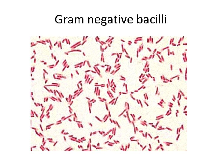 Gram negative bacilli 