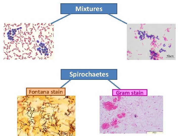 Mixtures Spirochaetes Fontana stain Gram stain 