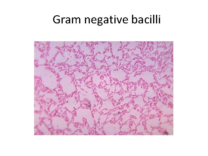 Gram negative bacilli 