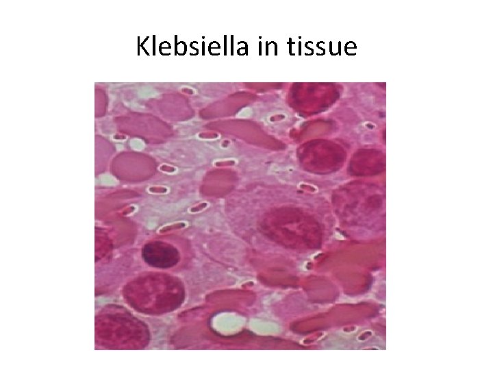 Klebsiella in tissue 