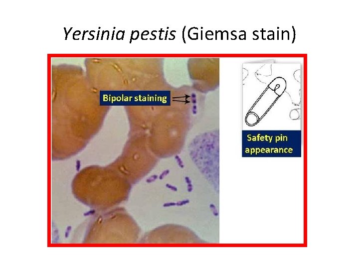 Yersinia pestis (Giemsa stain) 