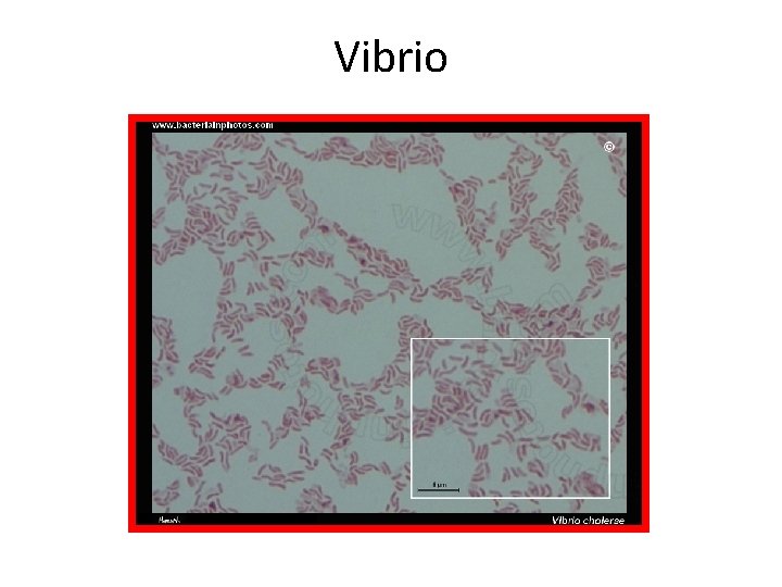 Vibrio 