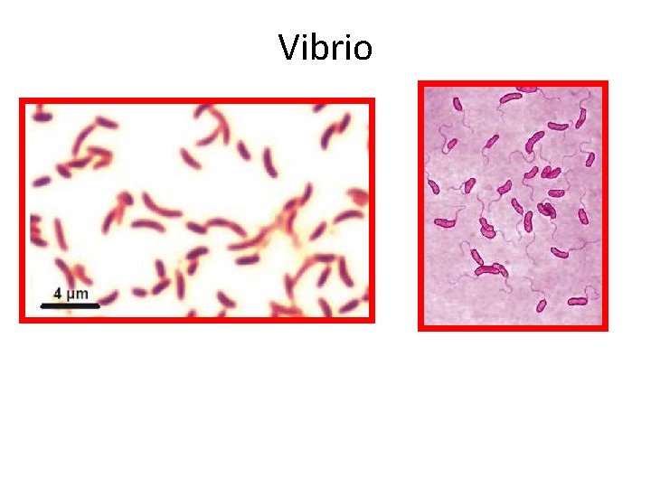 Vibrio 