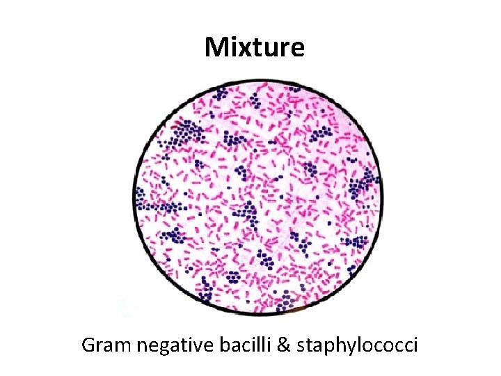 Mixture Gram negative bacilli & staphylococci 