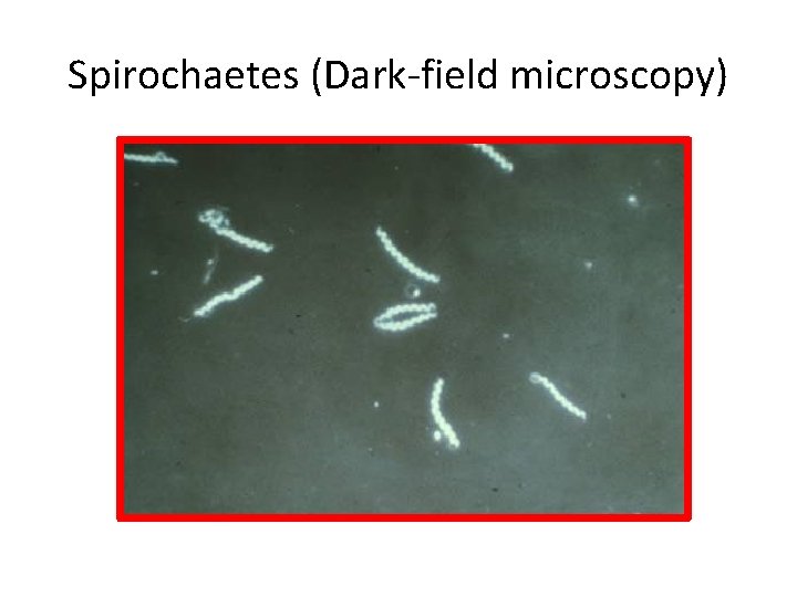 Spirochaetes (Dark-field microscopy) 