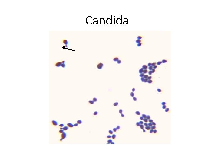 Candida 