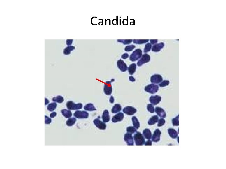 Candida 