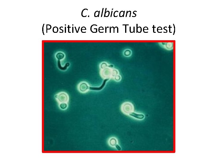 C. albicans (Positive Germ Tube test) 