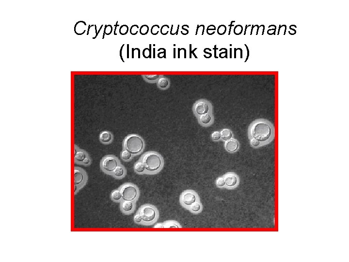 Cryptococcus neoformans (India ink stain) 