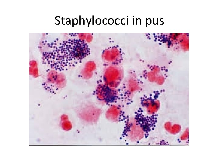 Staphylococci in pus 