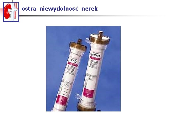 ostra niewydolność nerek 
