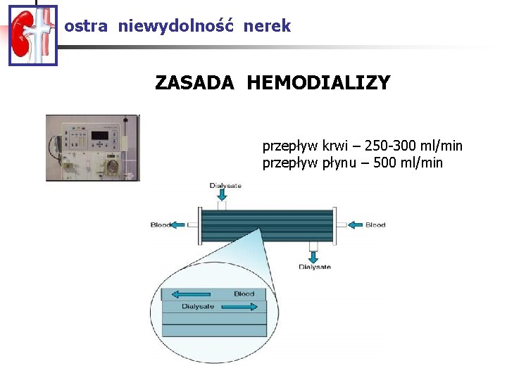 ostra niewydolność nerek ZASADA HEMODIALIZY przepływ krwi – 250 -300 ml/min przepływ płynu –