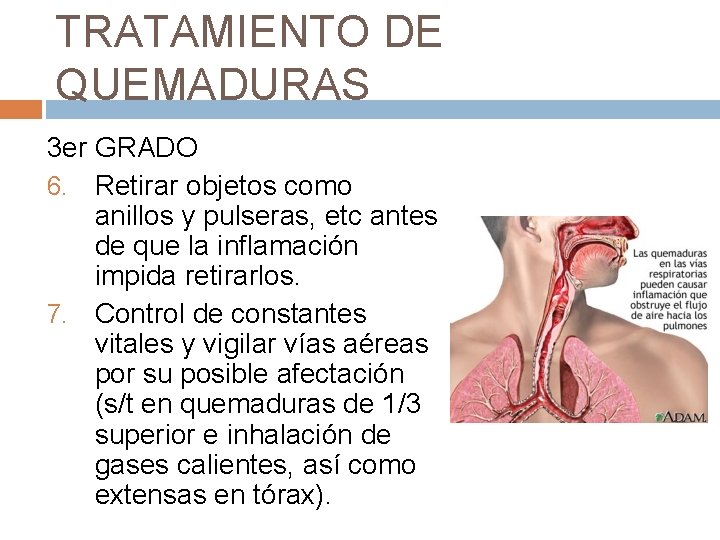 TRATAMIENTO DE QUEMADURAS 3 er GRADO 6. Retirar objetos como anillos y pulseras, etc