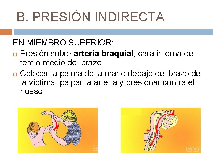 B. PRESIÓN INDIRECTA EN MIEMBRO SUPERIOR: Presión sobre arteria braquial, cara interna de tercio