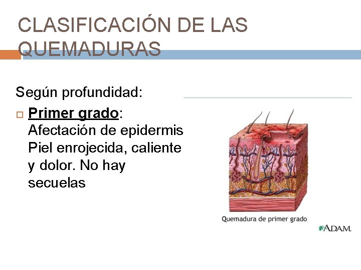 CLASIFICACIÓN DE LAS QUEMADURAS Según profundidad: Primer grado: Afectación de epidermis. Piel enrojecida, caliente