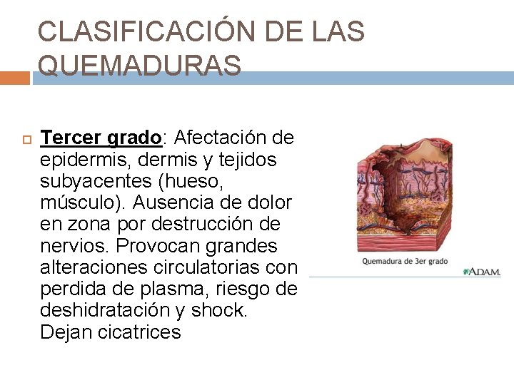 CLASIFICACIÓN DE LAS QUEMADURAS Tercer grado: Afectación de epidermis, dermis y tejidos subyacentes (hueso,