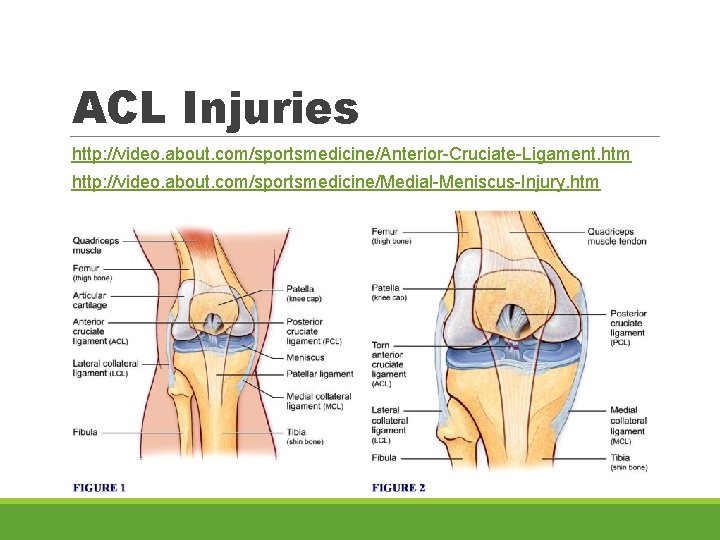 ACL Injuries http: //video. about. com/sportsmedicine/Anterior-Cruciate-Ligament. htm http: //video. about. com/sportsmedicine/Medial-Meniscus-Injury. htm 