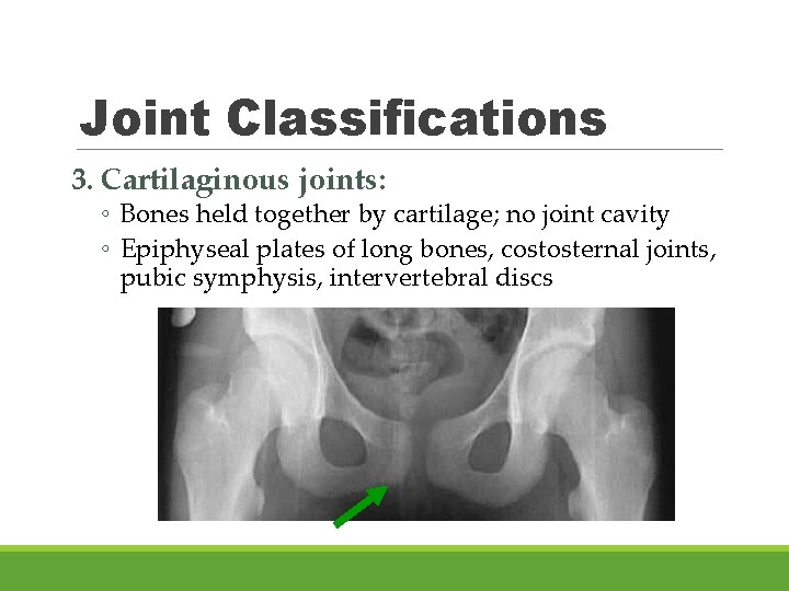 Joint Classifications 3. Cartilaginous joints: ◦ Bones held together by cartilage; no joint cavity