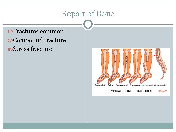 Repair of Bone Fractures common Compound fracture Stress fracture 
