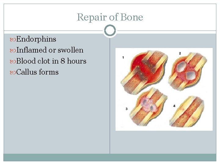 Repair of Bone Endorphins Inflamed or swollen Blood clot in 8 hours Callus forms