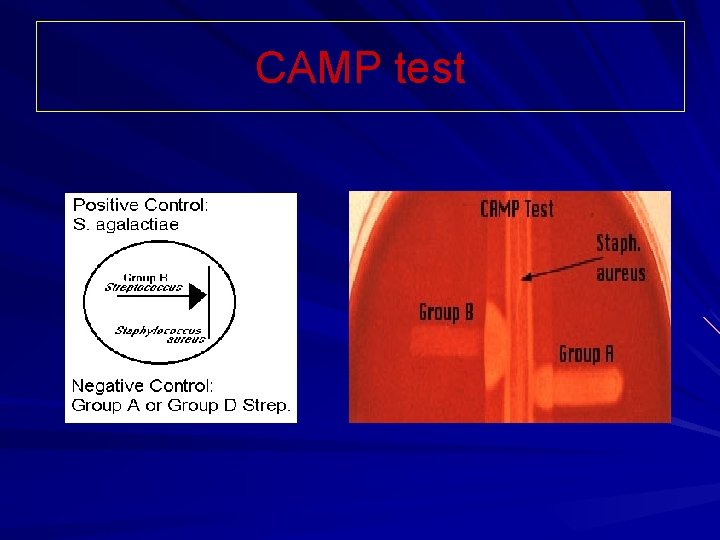 CAMP test 