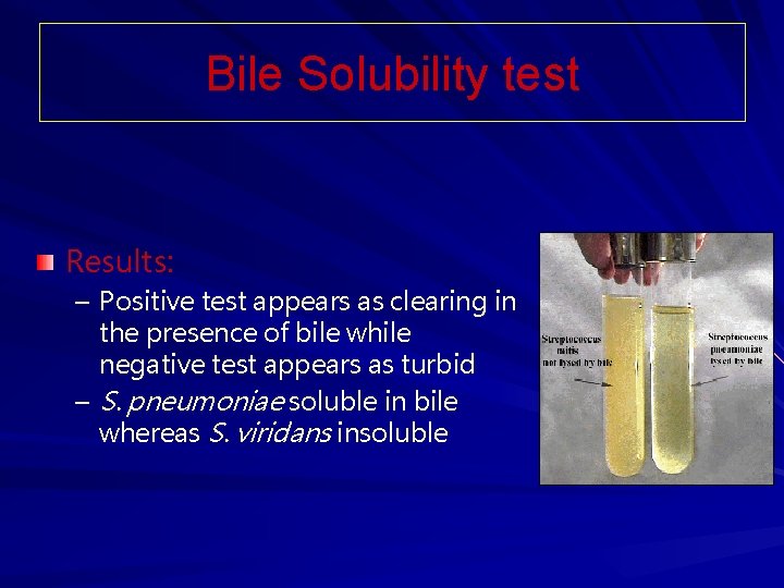 Bile Solubility test Results: – Positive test appears as clearing in the presence of