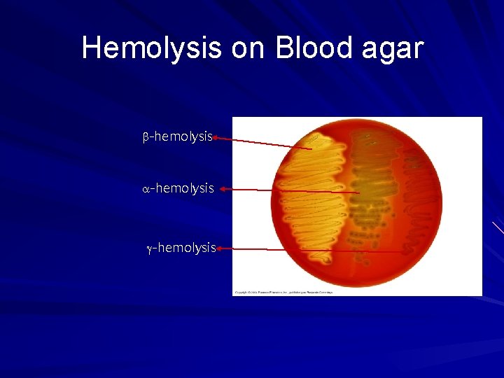 Hemolysis on Blood agar -hemolysis Hemolysis on Blood agar -hemolysis