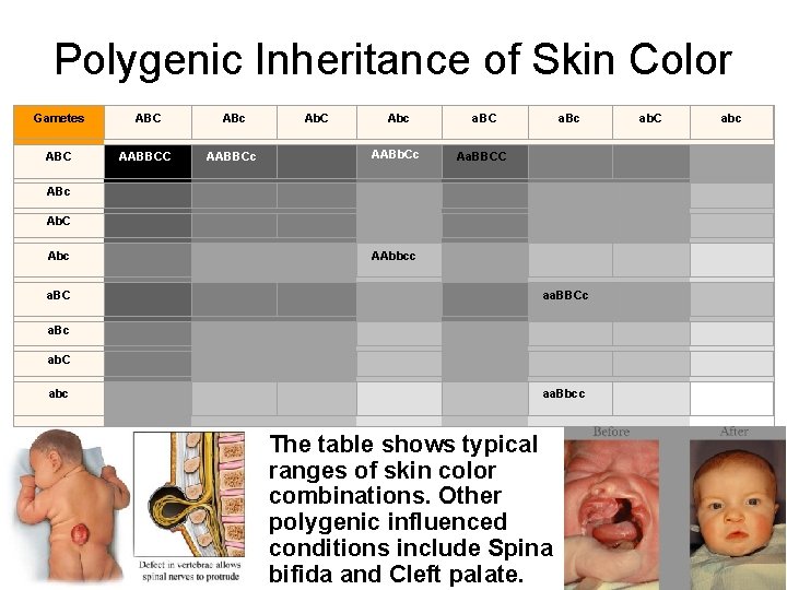 Polygenic Inheritance of Skin Color Gametes ABC ABc ABC AABBCc Ab. C Abc a.