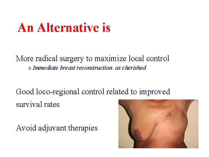 An Alternative is More radical surgery to maximize local control ± Immediate breast reconstruction An Alternative is More radical surgery to maximize local control ± Immediate breast reconstruction