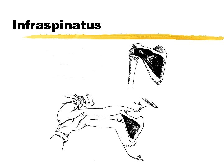 Infraspinatus 