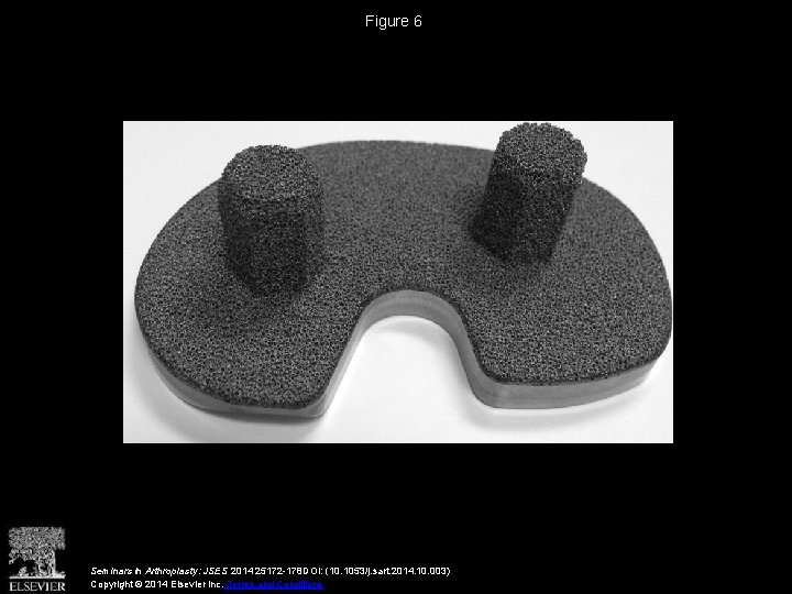 Figure 6 Seminars in Arthroplasty: JSES 2014 25172 -178 DOI: (10. 1053/j. sart. 2014.