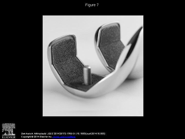 Figure 7 Seminars in Arthroplasty: JSES 2014 25172 -178 DOI: (10. 1053/j. sart. 2014.