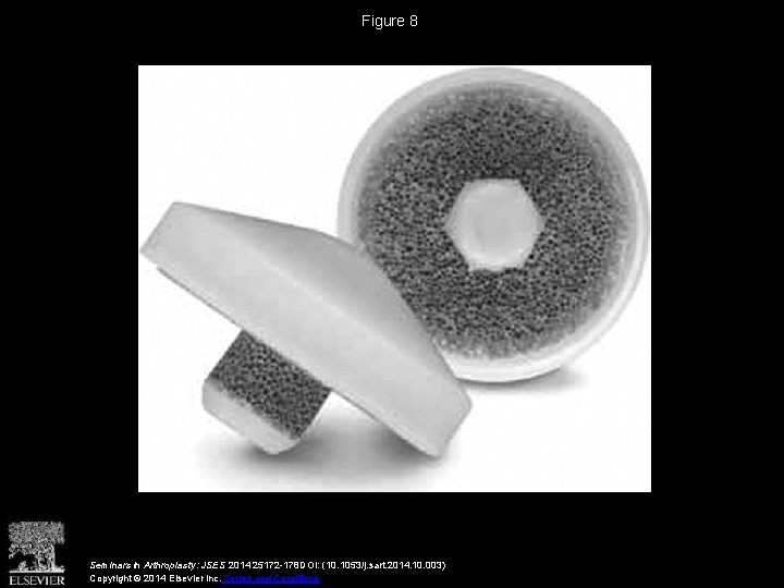 Figure 8 Seminars in Arthroplasty: JSES 2014 25172 -178 DOI: (10. 1053/j. sart. 2014.