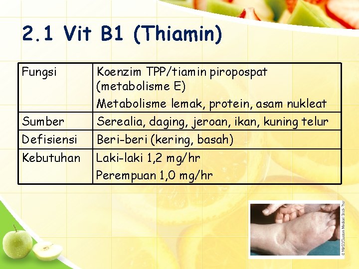 2. 1 Vit B 1 (Thiamin) Fungsi Sumber Koenzim TPP/tiamin piropospat (metabolisme E) Metabolisme