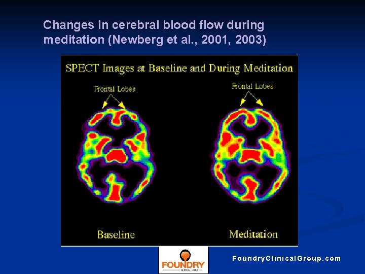 Changes in cerebral blood flow during meditation (Newberg et al. , 2001, 2003) Foundry.