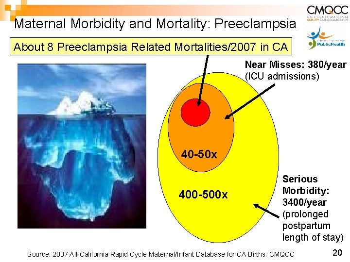 Maternal Morbidity and Mortality: Preeclampsia About 8 Preeclampsia Related Mortalities/2007 in CA Near Misses: