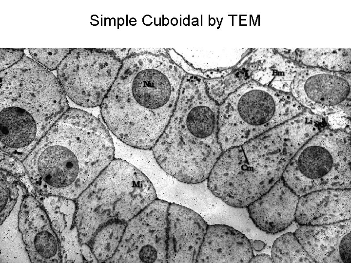 Simple Cuboidal by TEM 