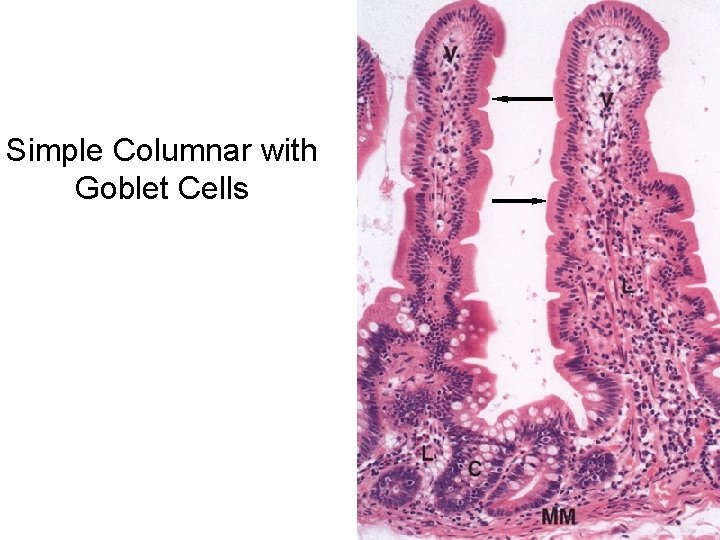 Simple Columnar with Goblet Cells 