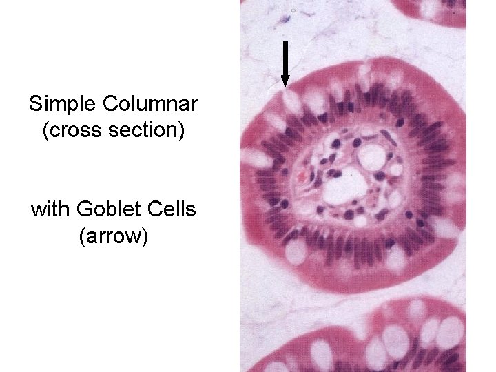 Simple Columnar (cross section) with Goblet Cells (arrow) 