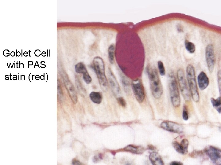 Goblet Cell with PAS stain (red) 