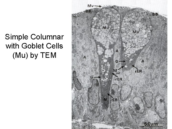 Simple Columnar with Goblet Cells (Mu) by TEM 