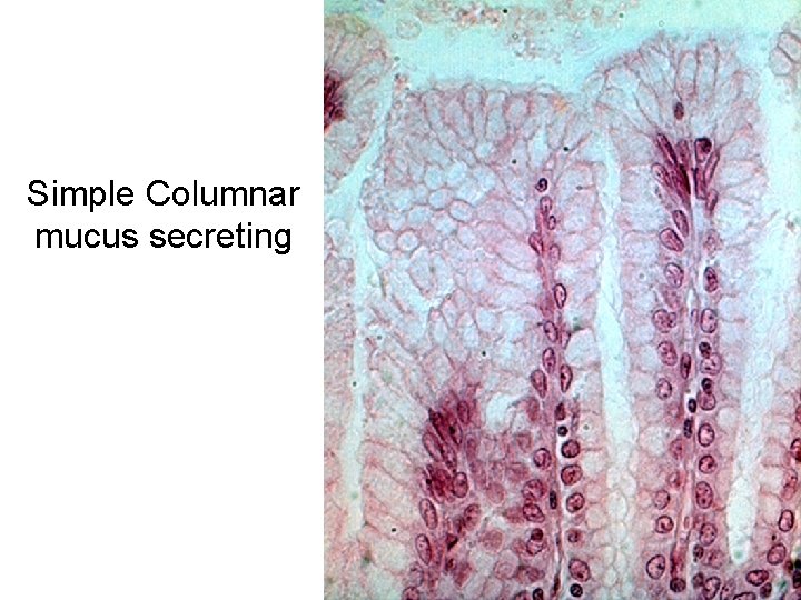 Simple Columnar mucus secreting 