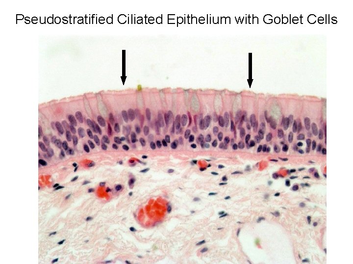 Pseudostratified Ciliated Epithelium with Goblet Cells 