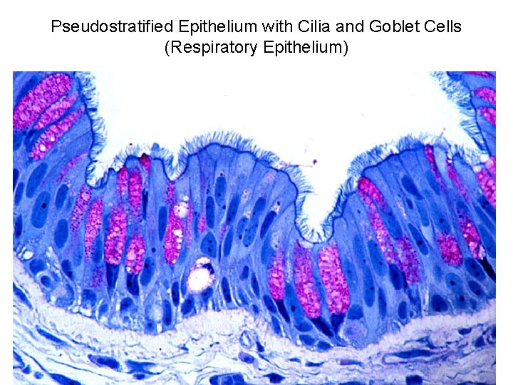 Pseudostratified Epithelium with Cilia and Goblet Cells (Respiratory Epithelium) 